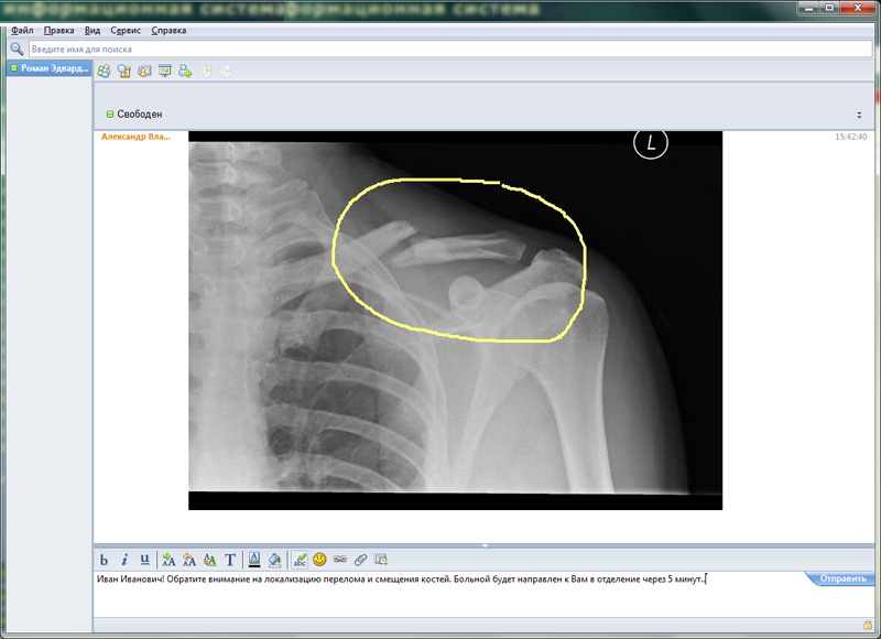 Окно функции мгновенного обмена сообщениями с пересылкой рентгенологического снимка, отметками и комментариями врача - как пример удаленной консультации специалистов друг с другом